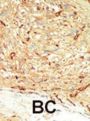 Macrophage Stimulating Protein/Hepatocyte Growth Factor Like (MST1) Antibody