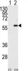 Macrophage Stimulating Protein/Hepatocyte Growth Factor Like (MST1) Antibody