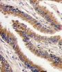 cAMP-Dependent Protein Kinase Catalytic Subunit PRKX (PRKX) Antibody