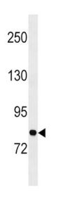 Glycyl-tRNA Synthetase (GARS1) Antibody