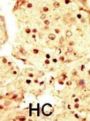 Mitogen-Activated Protein Kinase Kinase Kinase 9 (MAP3K9) Antibody