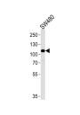 Mitogen-Activated Protein Kinase Kinase Kinase 9 (MAP3K9) Antibody