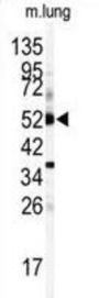 Cytochrome P450 1A1 (CYP1A1) Antibody