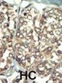 PI 4 Kinase type 2 beta Antibody