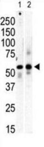 PI 4 Kinase type 2 beta Antibody