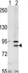 Bromodomain-Containing Protein 2 (BRD2) Antibody