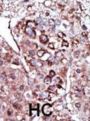 Diacylglycerol Kinase Zeta (DGKZ) Antibody