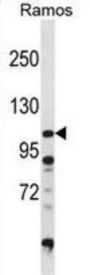Diacylglycerol Kinase Zeta (DGKZ) Antibody
