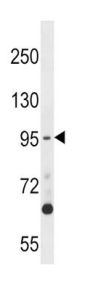 TTK Antibody