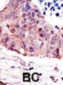GSK3 alpha Antibody