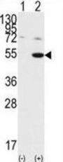 GSK3 alpha Antibody