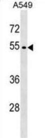 GSK3 alpha Antibody