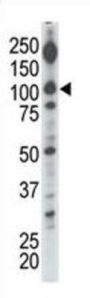 Diacylglycerol Kinase Iota (DGKI) Antibody