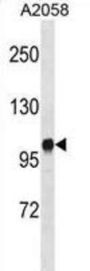 Diacylglycerol Kinase Iota (DGKI) Antibody