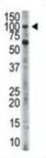 Hexokinase 3 (HK3) Antibody