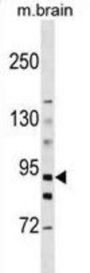 Hexokinase 3 (HK3) Antibody