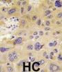 6-Phosphofructo-2-Kinase/fructose-2,6-Bisphosphatase 1 (PFKFB1) Antibody