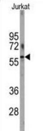 6-Phosphofructo-2-Kinase/fructose-2,6-Bisphosphatase 1 (PFKFB1) Antibody