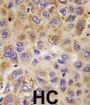 PFKFB1 Antibody