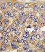 6-Phosphofructo-2-Kinase/fructose-2,6-Biphosphatase 4 (PFKFB4) Antibody