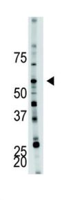 6-Phosphofructo-2-Kinase/fructose-2,6-Biphosphatase 4 (PFKFB4) Antibody