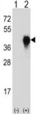 Urokinase Plasminogen Activator Surface Receptor / uPAR / CD87 (PLAUR) Antibody