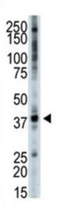 Tribbles Homolog 3 (TRIB3) Antibody