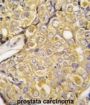 Transient Receptor Potential Cation Channel Subfamily M Member 8 (TRPM8) Antibody