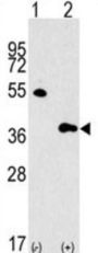 G Protein Beta Subunit Like Protein (GBL) Antibody