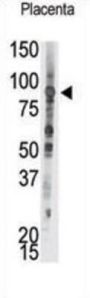 PTP epsilon Antibody