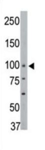 Protein-Tyrosine Phosphatase H1 (PTPH1) Antibody
