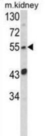 SIL1 Nucleotide Exchange Factor (SIL1) Antibody