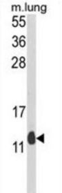 PEA-15 Antibody