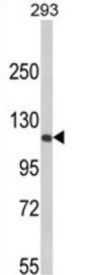 Retinoblastoma Protein 1 (RB1) Antibody