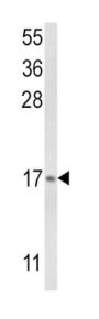 Leukotriene C4 Synthase (LTC4S) Antibody