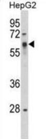 SRC Proto-Oncogene, Non-Receptor Tyrosine Kinase (SRC) Antibody
