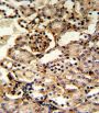 Guanine Monophosphate Synthase (GMPS) Antibody