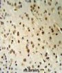 Threonyl-tRNA Synthetase Like 2 (TARSL2) Antibody
