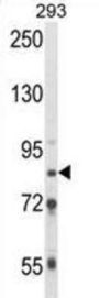 Threonyl-tRNA Synthetase Like 2 (TARSL2) Antibody