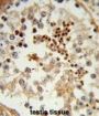 Heat Shock 70 kDa Protein 4L (HSPA4L) Antibody