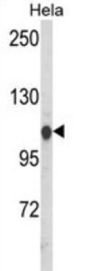Heat Shock 70 kDa Protein 4L (HSPA4L) Antibody