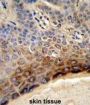 CTHRC1 Antibody