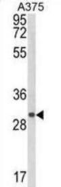 CTHRC1 Antibody