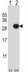 CTHRC1 Antibody