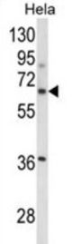 Integrin Beta-Like Protein 1 (ITGBL1) Antibody