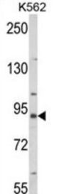 Mitofusin-2 (MFN2) Antibody