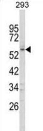 Forkhead Box Protein C1 (FOXC1) Antibody