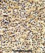 DTX1 Antibody