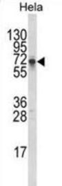 DTX1 Antibody