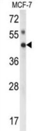 Inositol Polyphosphate Multikinase (IPMK) Antibody